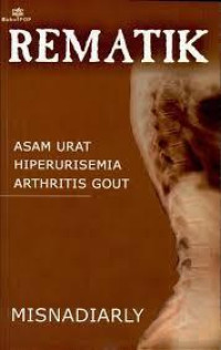 Rematik : Asam Urat Hiperurisemia Arthritis Gout